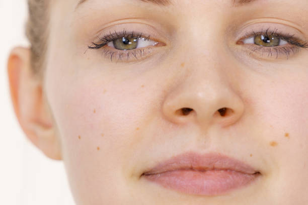 istock Female face with no makeup 2149988572