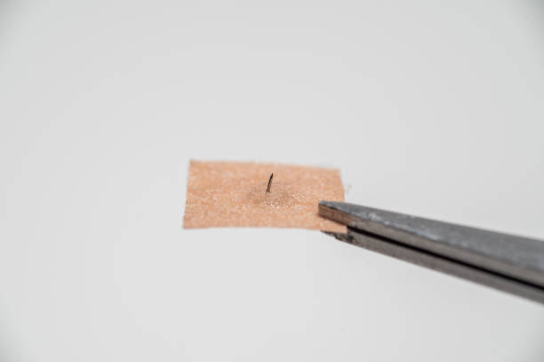 istock Auriculotherapy (also auricular therapy, ear acupuncture, and auriculoacupuncture) is a form of alternative medicine 2150119038