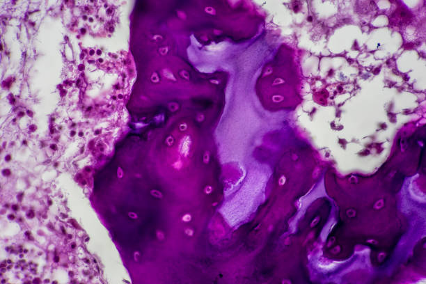 istock Tissue sample of Bone human, Elastic cartilage human and Red bone marrow under the microscope in Lab. 2150230986