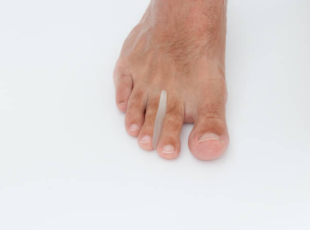 istock Silicone toe separator for straightenins toes 2150305619