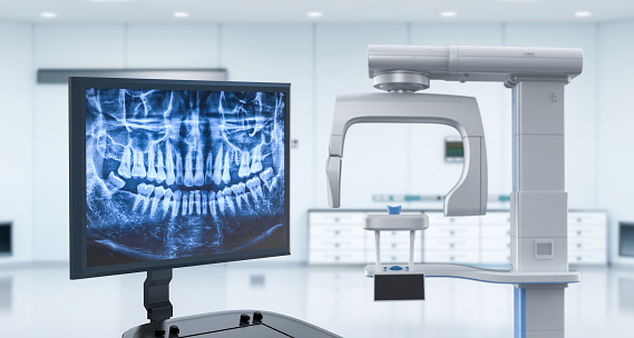 3d rendering digital x-ray film on monitor with scanner machine in dental office
