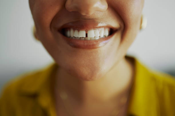 la sonrisa más brillante - hueco entre dientes fotografías e imágenes de stock