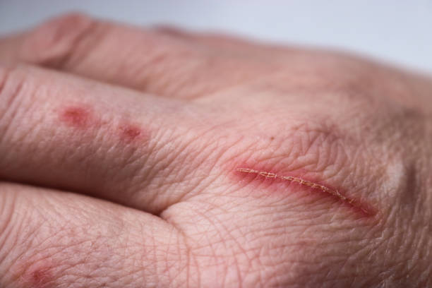 istock Close-up of a pet owner's scratched hand. Selective Focus 2150613229