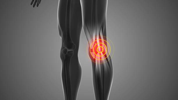 istock Knee discomfort that triggers pain 2150626765