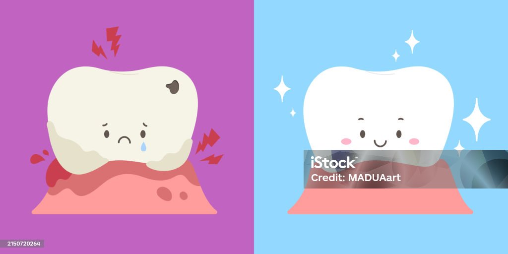 Weak Tooth Weak Tooth With Lesions Compare With Strong Tooth Stock Illustration ...