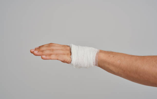 istock bandaged arm health problem patient injury Studio 2150980621