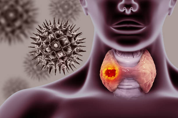 istock Thyroid gland cancer. showing thyroid gland with tumor. 3d illustration 2151077099