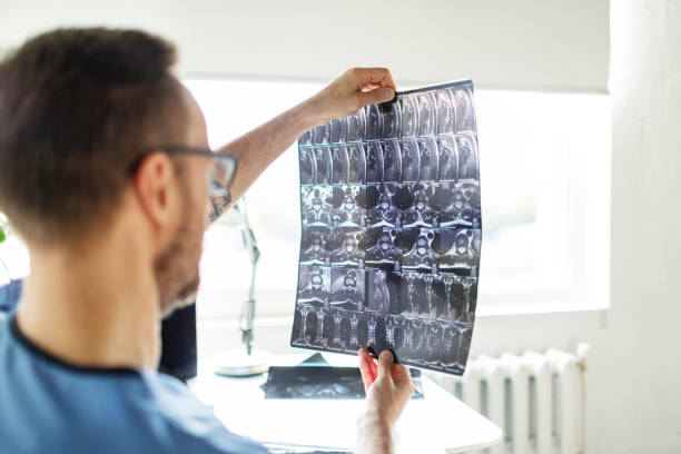istock Doctor checking patient's spine x-ray image 2151138972