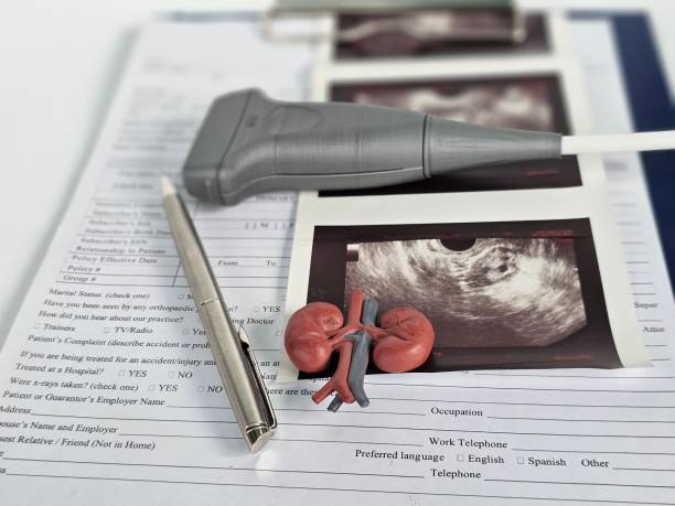 istock Clipboard With Kidney Picture and Pen 2151216397