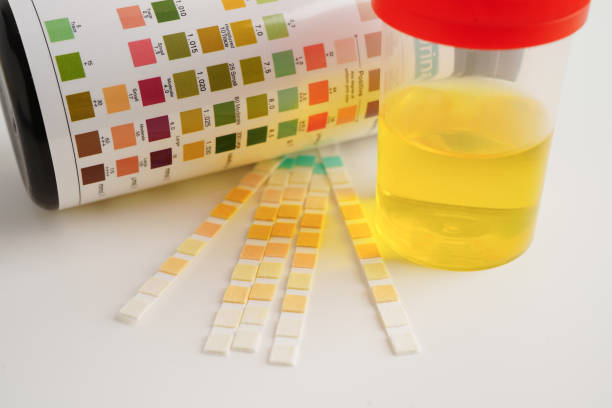 istock Urinalysis, urine cup with reagent strip pH paper test and comparison chart in laboratory. 2151268256