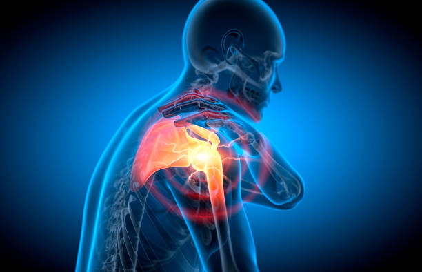 istock Man with painful shoulder illustration 2151303799