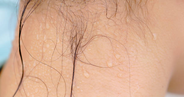 Closeup asian businesswoman back neck sweat and stuffy