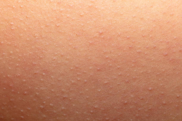 Human skin as an abstract background. Texture.