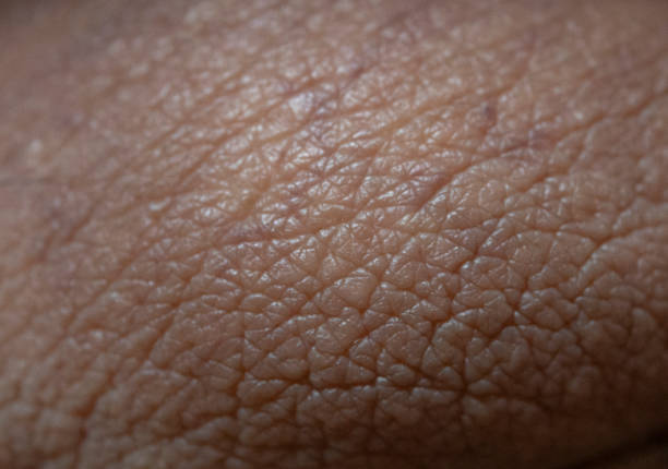 istock Human skin folds 2151436926