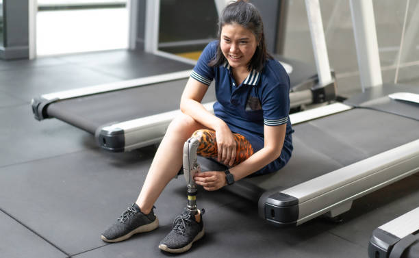 istock Asian female with mechanical prosthesis leg workout for wellbeing. 2151503525