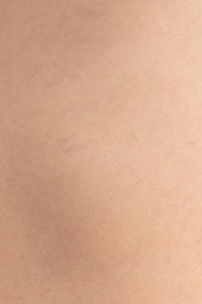 istock Flat Caucasian skin texture 2151566240