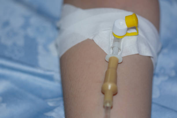 procedure for receiving an IV in a hospital