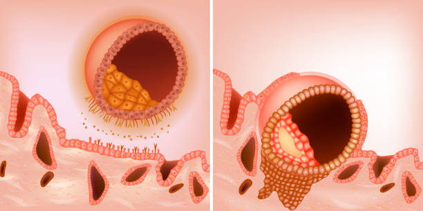 The process during the embryo implantation. The blastocyst implants to the maternal endometrium. Blastocyst Apposition and Adhesion The process during the embryo implantation. The blastocyst implants to the maternal endometrium. Blastocyst. Apposition and Adhesion zygote drawing stock illustrations