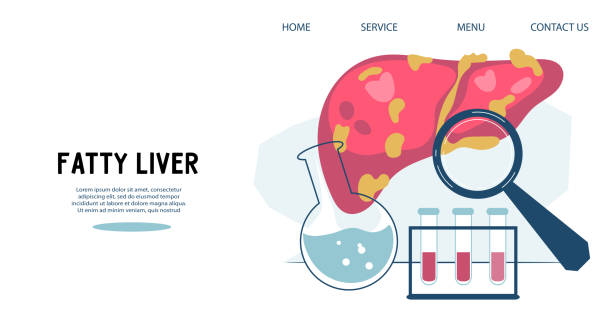 Fatty liver or hepatic steatosis disease poster or banner template vector illustration. Fatty liver or hepatic steatosis disease poster or banner template for spreading health information and avoid pathology, flat vector illustration. fatty liver screening stock illustrations