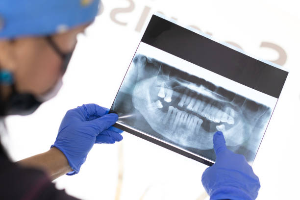 istock doctor pointing at x-ray exams 2151790329