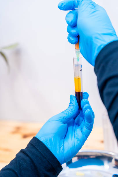 istock Nurse extracting centrifuged blood to inject it into baldness treatment 2151885459
