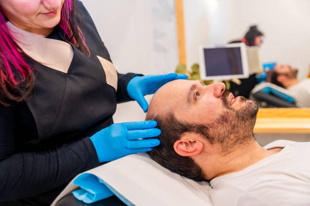 istock Dermatologist inspecting the bald man's head before a hair treatment 2151885687