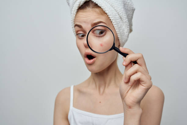 istock woman with a towel on her head magnifies pimple skin problems through a magnifier 2152307002