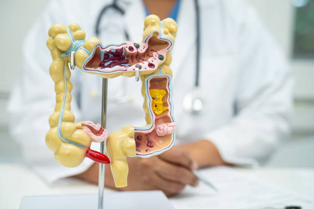 istock Intestine, appendix and digestive system, doctor holding anatomy model for study diagnosis and treatment in hospital. 2152323273
