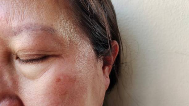 istock The wrinkle and dark spots on the face. 2152570821