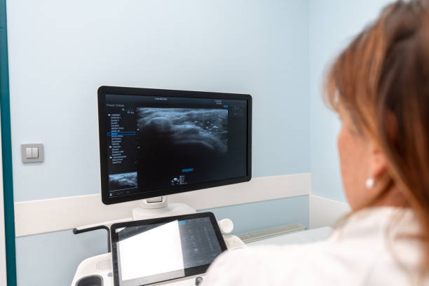istock Caucasian Female Sonographer and Ultrasound Expert 2152979144