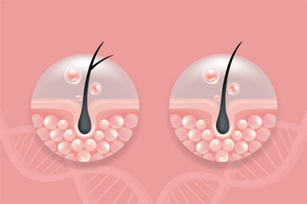 istock Hyaluronic acid before and after hair and skin solutions ad, pink removing serum drop over skin cells with cosmetic advertising background ready to use, illustration vector. 2153476450