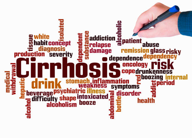 istock Word Cloud with CIRRHOSIS concept create with text only 2153850897