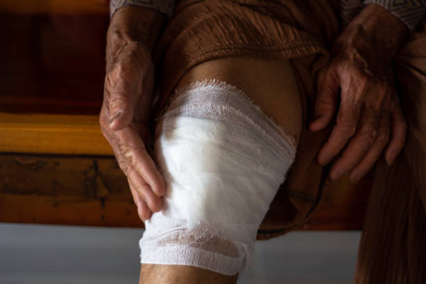 An old woman has a wound on knee. The wound was caused by a fall. An old woman has a wound on knee. stitches wound surgery nurse stock pictures, royalty-free photos & images