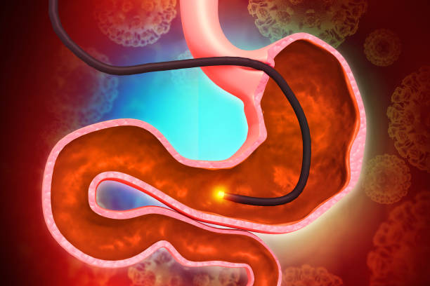istock Human Stomach with endoscope and close-up view of bacterium Helicobacter pylori which causes ulcers, stomach ulcer or gastric ulcer, 3d illustration 2154279609