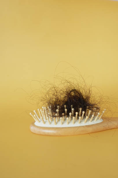 istock a brush with lost hair on table 2154327444