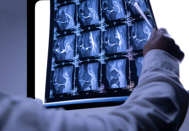 Cool x-ray with doctor holding imaging