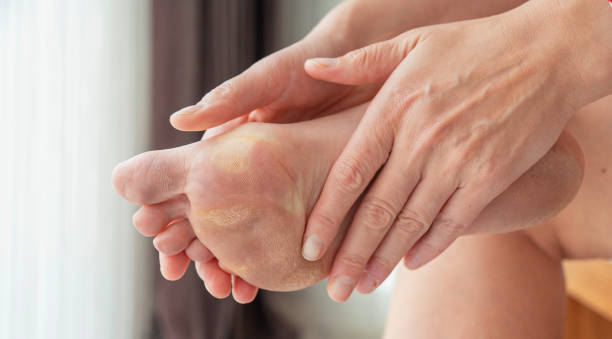istock dirty and neglected feet 2154589632