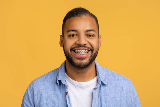 istock Cheerful young black man with dental braces posing against yellow background 2154645202