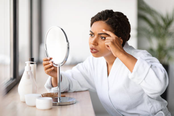 istock Upset Black Woman With Problem Skin Looking At Pimple On Forehead 2154649534