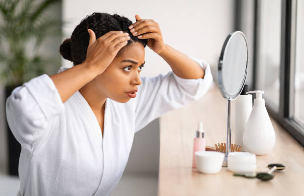istock Dandruff Problem. Upset Black Woman Looking To Mirror At Her Hair Roots 2154649561