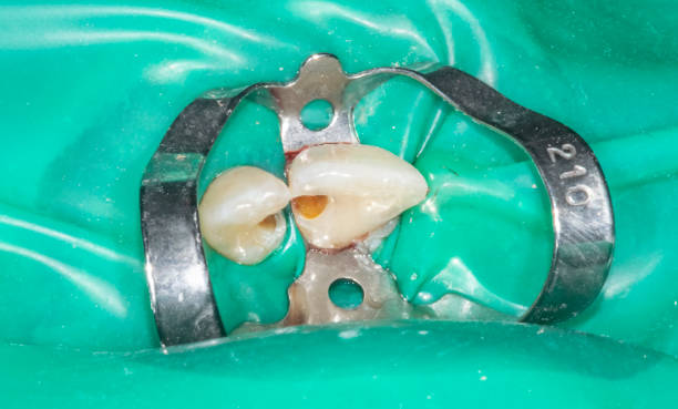 istock Dentistry treatment case close-up view. 2154757667