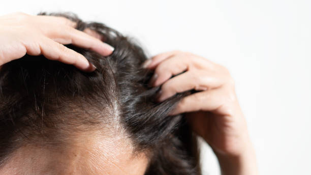 istock woman have hairless problem 2154881035