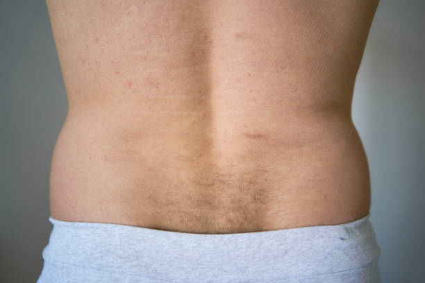 istock back and lower back of a thirty year old man of medium build 2154906858