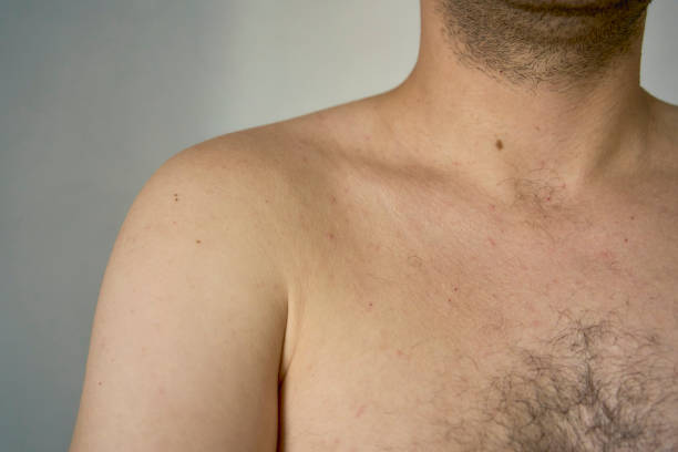 istock shoulder of a thirty-year-old man of medium build 2154906868