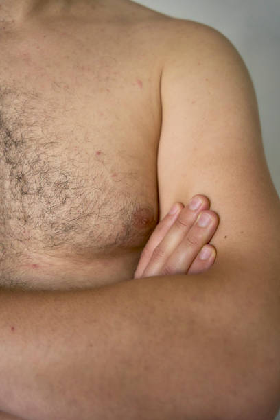 the shoulder of a thirty-year-old man of medium build