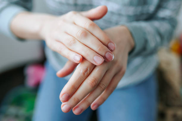 istock Close up female hands rubbing moisturizer applying cream in skin. 2154970180