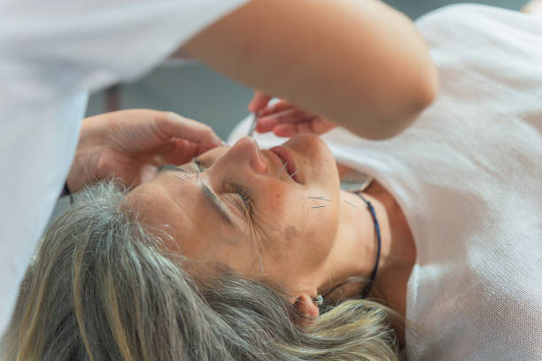Close-up of facial acupuncture treatment to an elderly woman. Alternative medicine concept Close-up of facial acupuncture treatment to an elderly woman. Alternative medicine concept. acupuncture model stock pictures, royalty-free photos & images