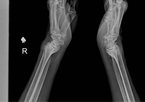 istock Medical X-ray of Human Hand Bones 2155200996