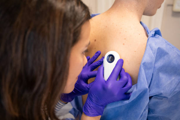 istock Female dermatologist examining her patient with a dermatoscope 2155223387