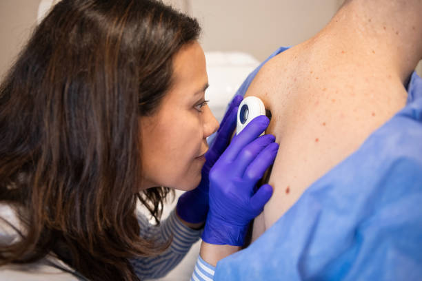 Female dermatologist examining her patient with a dermatoscope